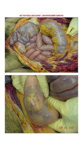 很恶心的照片,揭秘那些令人作呕的恐怖瞬间